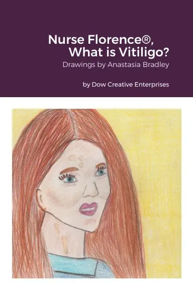 Nurse Florence¨, What Is Vitiligo? 1